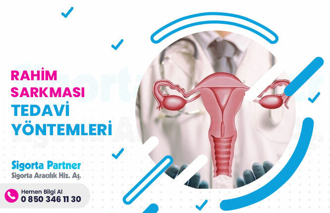 Rahim Sarkması Tedavi Yöntemleri