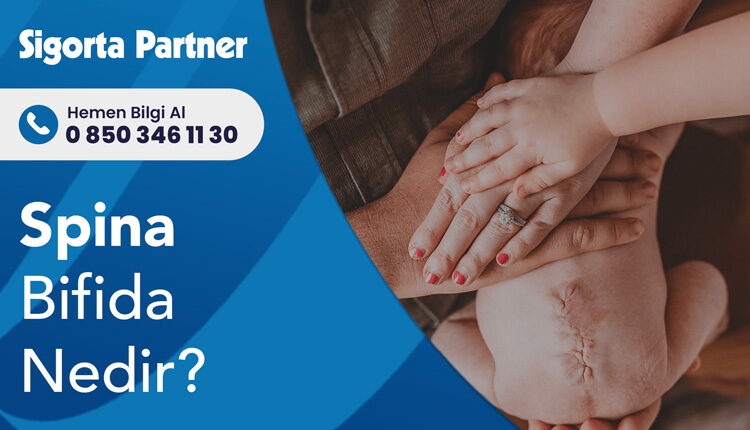Spina Bifida Nedir?