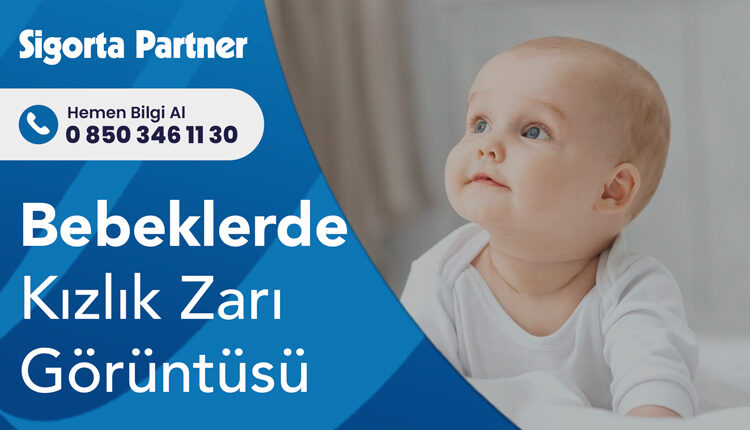 Bebeklerde Kızlık Zarı Görüntüsü