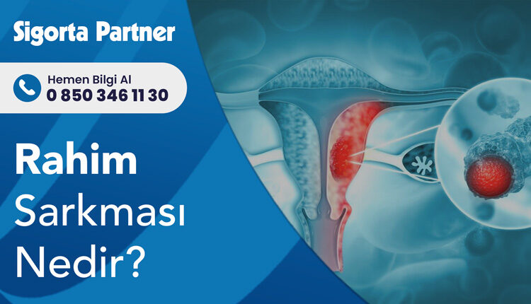 Rahim Sarkması Nedir